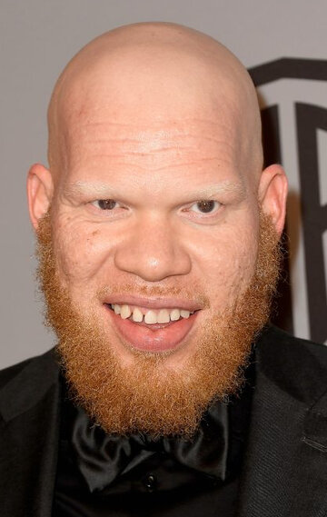 Marvin &laquo;Krondon&raquo; Jones III